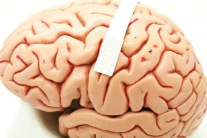 این ایمپلنت مغزی افکار را با دقت 84 درصد به گفتار تبدیل می‌کند