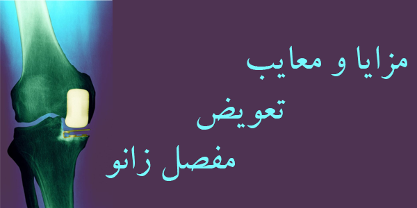 تعویض مفصل زانو؛ راهی نوین برای کاهش درد و بهبود کیفیت زندگی 2 مفصل زانو