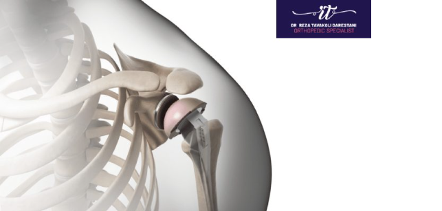 جراحی شانه: راهکار قطعی برای درمان درد و محدودیت حرکتی